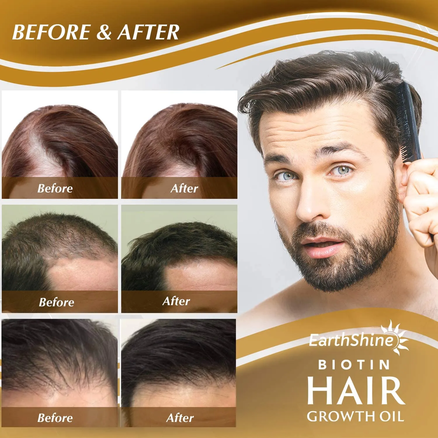 Biotin Hair Re Growth Oil For Men and Women