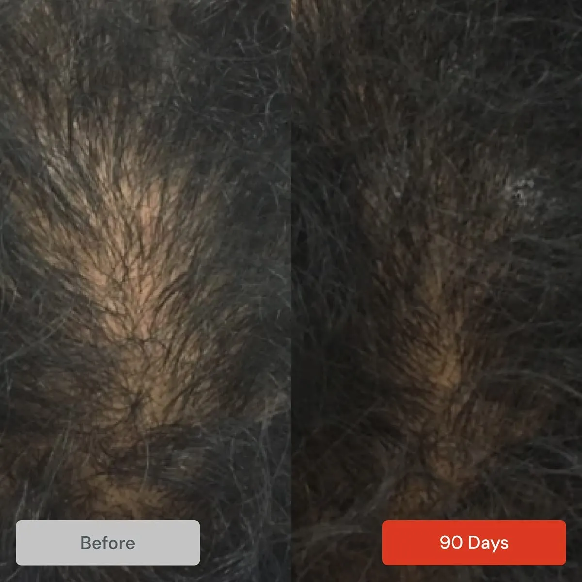 Revita Hair Loss Shampoo for Men and Women, Biotin & Caffeine
